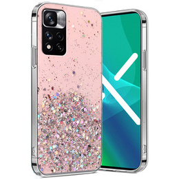 Чoхол до Xiaomi Redmi Note 11 Pro 4G/5G, Glittery, рожевий